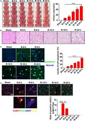 Methyltransferase 3 Mediated miRNA m6A Methylation Promotes Stress Granule Formation in the Early Stage of Acute Ischemic Stroke